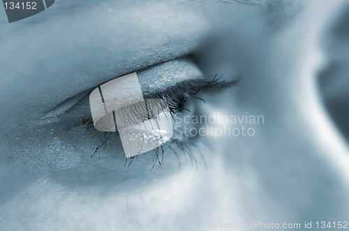 Image of Eye