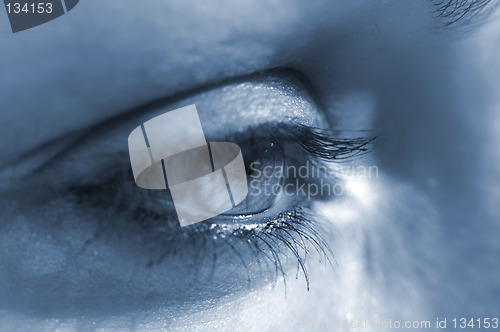 Image of Eye