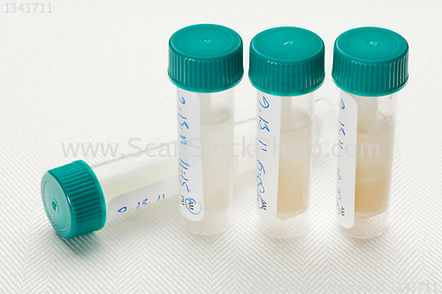 Image of saliva samples for laboratory test