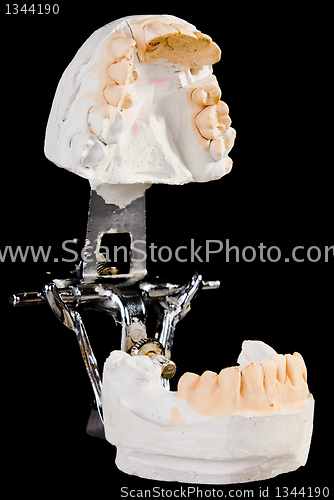 Image of alabaster cast jaws man