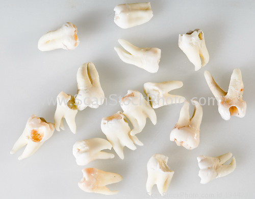 Image of remote root human teeth 
