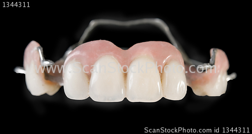 Image of dental implants