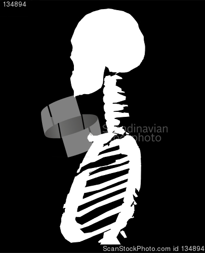 Image of Bone Cross Section