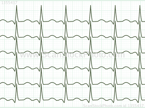 Image of Heart cardiogram. EPS 8