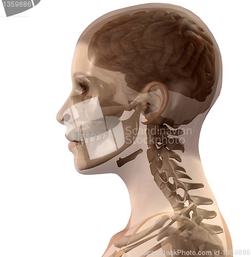 Image of Head X Ray