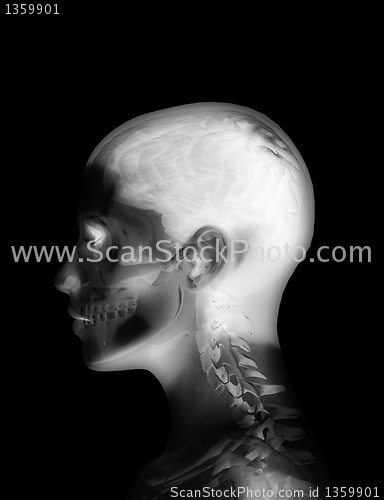 Image of Head X Ray