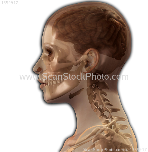 Image of Head X Ray