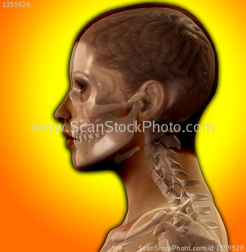 Image of Head X Ray