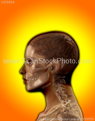 Image of Head X Ray