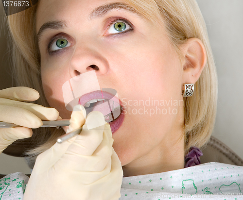 Image of At the dentist