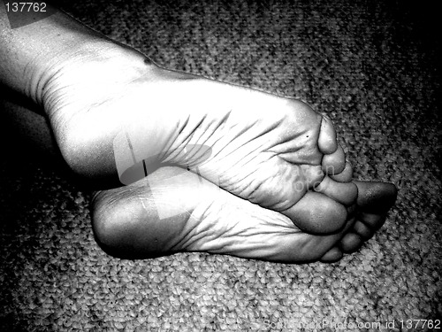 Image of feet 14
