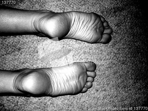 Image of feet 9
