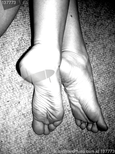 Image of feet 2