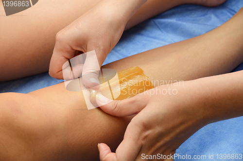 Image of sugaring epilation