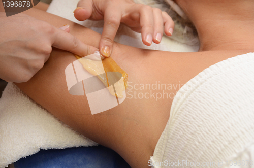 Image of sugaring epilation