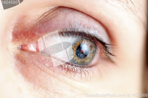 Image of Green eye