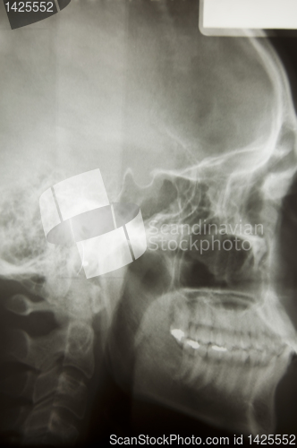 Image of Skull X-Ray