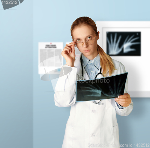 Image of doctor woman with x-ray picture