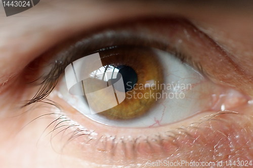 Image of Eye