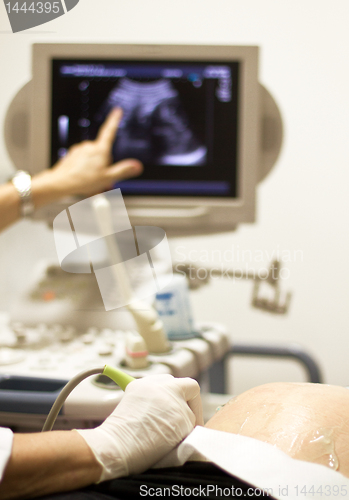 Image of medical examining by ultrasonic scan