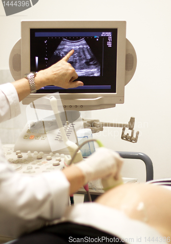 Image of medical examining by ultrasonic scan