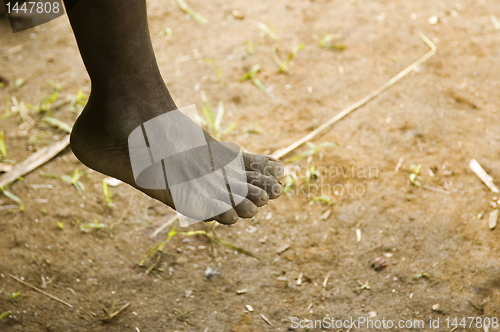 Image of Foot