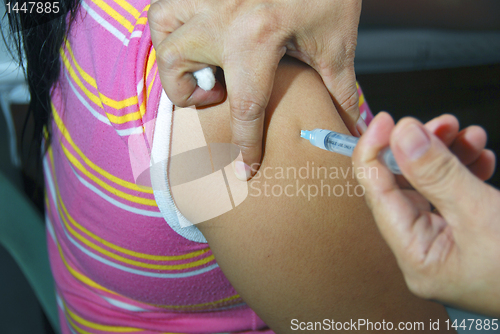 Image of Injection