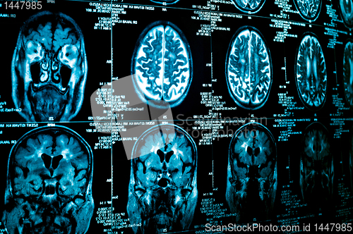 Image of Closeup of a computer axial tomography scan (CAT scan)