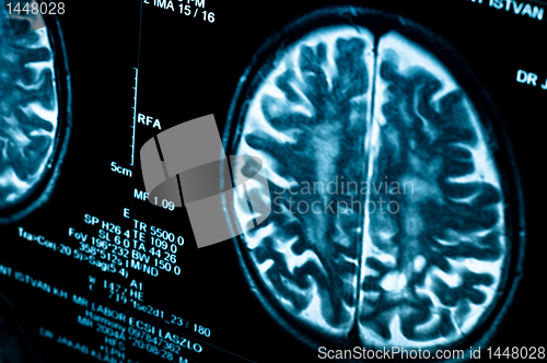 Image of Closeup of a computer axial tomography scan (CAT scan)