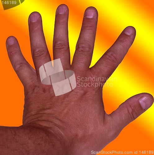 Image of six fingers