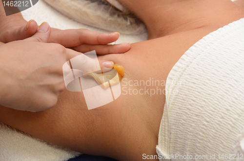 Image of sugaring epilation