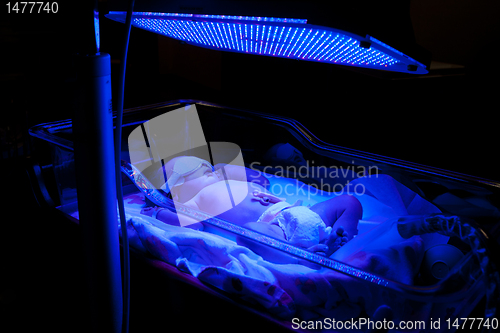Image of Baby with Phototherapy