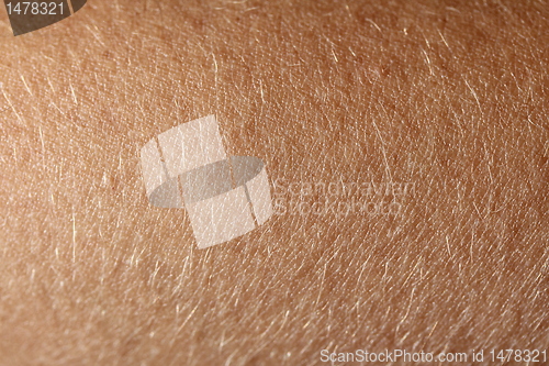 Image of skin texture