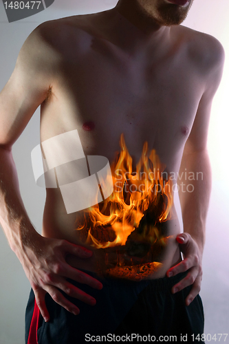 Image of Heartburn 