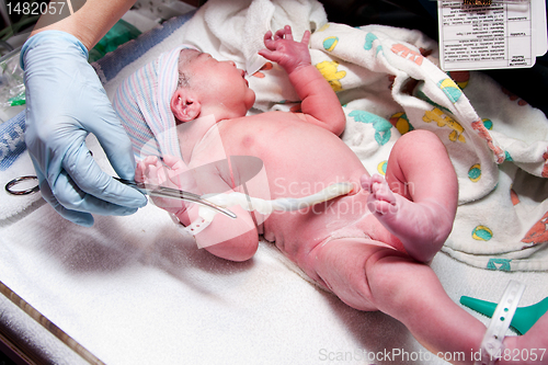 Image of Newborn cute infant baby with umbilical cord