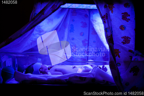 Image of Baby under Phototherapy