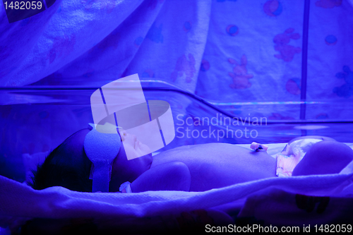 Image of Baby under Phototherapy