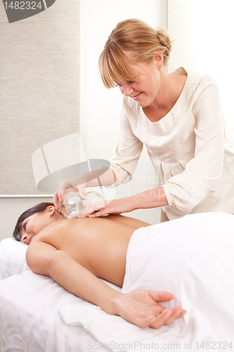 Image of Fire Cupping Acupuncture treatment