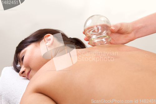 Image of Relaxed Woman after Fire Cupping