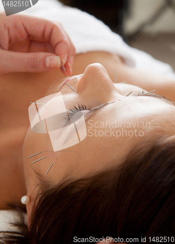 Image of Facial Acupuncture Beauty Treatment