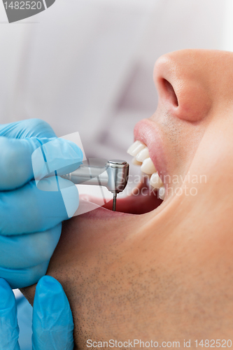 Image of Drill Dentist