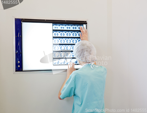 Image of Doctor examining an X-Ray image