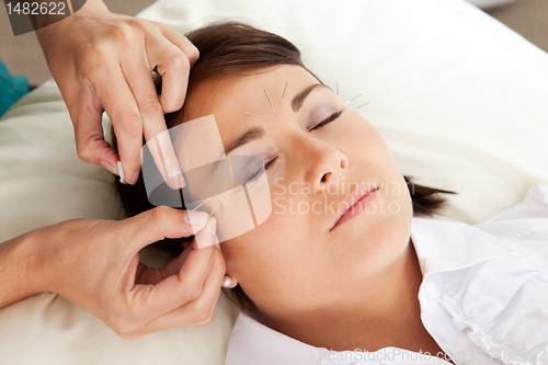 Image of Acupuncture Therapist Placing Needle in Face