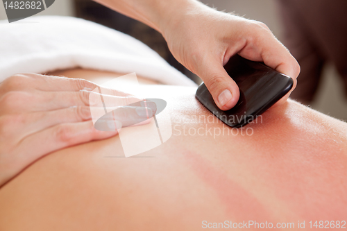 Image of Gua-Sha Acupuncture Treatment on Back