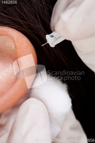 Image of Auricular Acupuncture Macro