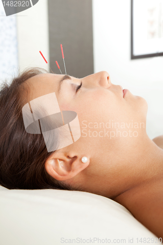 Image of Facial Acupuncture