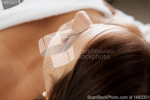 Image of Facial Acupuncture Beauty Treatment
