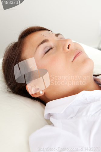 Image of Facial Beauty Acupuncture Treatment
