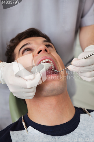 Image of Dental Molds