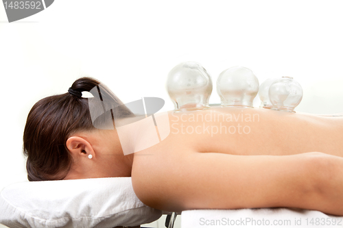 Image of Cupping Treatment Detail